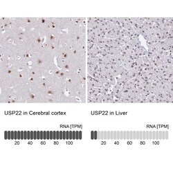 USP22 Antibody, Novus Biologicals:Antibodies:Primary Antibodies